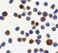 AP05826PU-N - Acinus / ACIN1