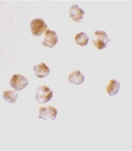 AP05827PU-N - Acinus / ACIN1