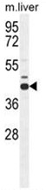 AP50117PU-N - AdoHcyase / AHCY