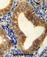 AP50117PU-N - AdoHcyase / AHCY