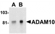 AP05830PU-N - CD156c / ADAM10
