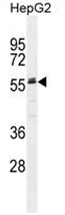 AP50120PU-N - Alpha-2-HS-glycoprotein / AHSG