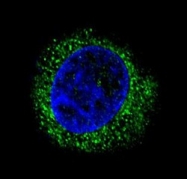 AP50120PU-N - Alpha-2-HS-glycoprotein / AHSG
