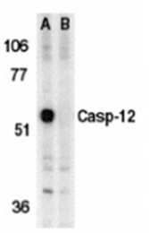AP05835PU-N - Caspase-12