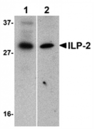 SP1413P - BIRC8 / ILP2