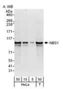 SP2109P - Nibrin