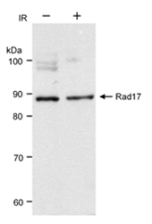 SP2111P - RAD17