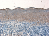 AP05879PU-N - SMC1A / SMC1