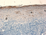 AP05879PU-N - SMC1A / SMC1