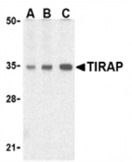 SP2072P - TIRAP