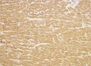 SP2072P - TIRAP