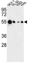 AP50126PU-N - AIM2