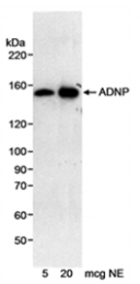 SP2073P - ADNP