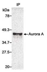 SP2058P - Aurora kinase A