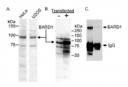 SP2059P - BARD1