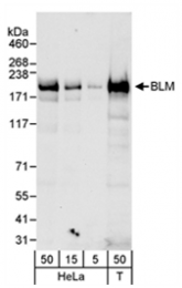 SP2060P - BLM