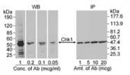 SP2056P - CHK1