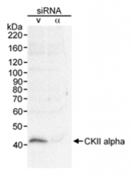 SP2062P - Casein kinase II subunit alpha