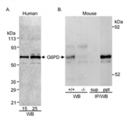 AP05884PU-N - G6PD