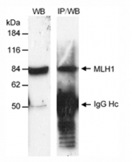 SP2066P - MLH1