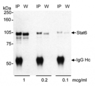 SP2071P - STAT6