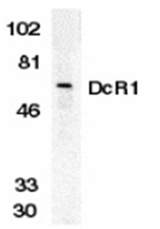 SP2114P - CD263 / TRAILR3