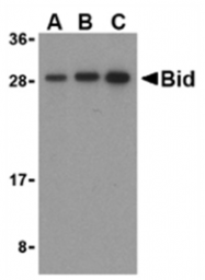SP2115P - BID