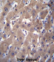 AP50131PU-N - AKR1C2 / DDH2