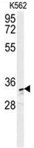 AP50133PU-N - AKR1C3 / DDH3
