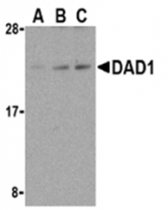 SP2117P - DAD1