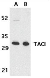 SP2135P - CD267 / TACI