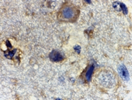 SP2154P - RHEB