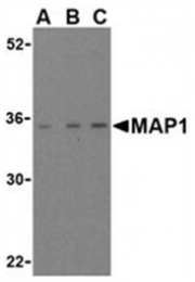 SP2153P - MOAP1