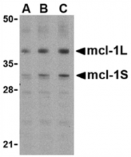 SP2170P - MCL1
