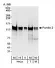 AP05992PU-N - Pumilio 2 / PUM2