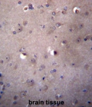 AP50142PU-N - ALDH3B2 / ALDH8