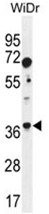 AP50143PU-N - Aldolase C / ALDOC