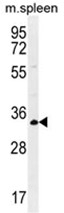 AP50143PU-N - Aldolase C / ALDOC
