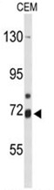 AP50153PU-N - ALOX15B