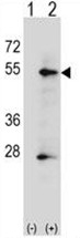 AP50155PU-N - Alkaline phosphatase / PLAP / ALPP
