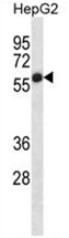 AP50155PU-N - Alkaline phosphatase / PLAP / ALPP