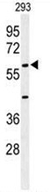 AP50161PU-N - Anti-Muellerian Hormone / AMH