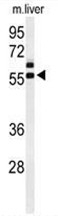 AP50161PU-N - Anti-Muellerian Hormone / AMH