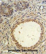 AP50161PU-N - Anti-Muellerian Hormone / AMH