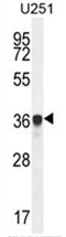 AP50163PU-N - AMN1