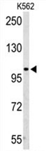 AP50165PU-N - AMP deaminase 2 / AMPD2