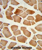 AP50165PU-N - AMP deaminase 2 / AMPD2