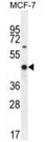 AP54572PU-N - WT1 / Wilms tumor protein