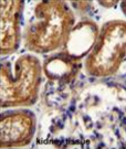 AP54572PU-N - WT1 / Wilms tumor protein