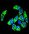 AP54572PU-N - WT1 / Wilms tumor protein